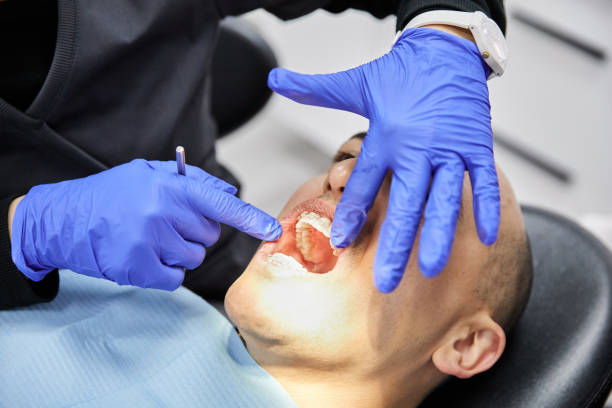 Best Emergency Tooth Extraction in Columbia, SC